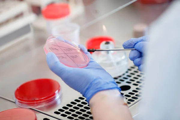 Microbiologie hand medisch werken op agar plaat cultuur bacteriën en resistentie van ziekteverwekkers in laboratorium en bacteriële identificatie — Stockfoto