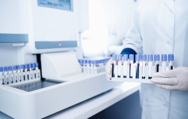 Laboratuvarda tıbbi teknisyen kan testi