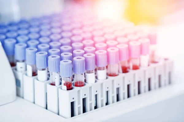 Laboratoriummedewerker bereidt testbloed voor op detectie van antilichamen en infecties Corona virus — Stockfoto