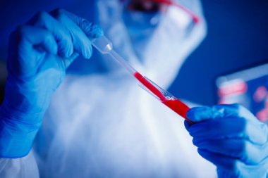 Hemşire Biyolojik Tehlike, sağlık laboratuarında kan testi pozitif çıktı.