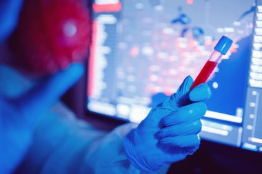 Çin 'de ve dünyada virüsten etkilenen insanların sayısı analiz ediliyor. Laboratuvarda solunum cihazına bağlı koruyucu kimyasal giysili bir doktor.