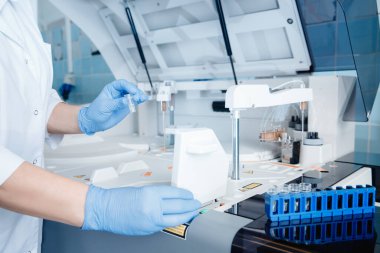 Laboratuvar teknisyeni test örneğini otomatik ekspres test cihazına yerleştirdi