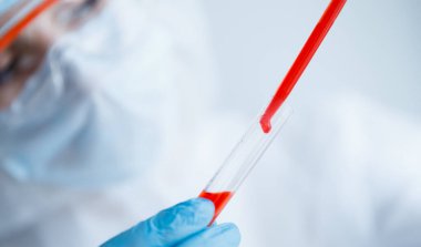 Çin 'deki ve Dünya' daki Coronavirus virüsünün analizi. Laboratuvarda solunum cihazıyla koruyucu kimya giysisi giyen doktor.