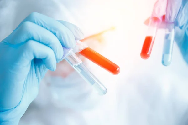 화학 실험실의 의사는 바이러스 백신을 개발하기 위한 검사를 분석 한다. 개념 인류와 코로나 바이러스 — 스톡 사진