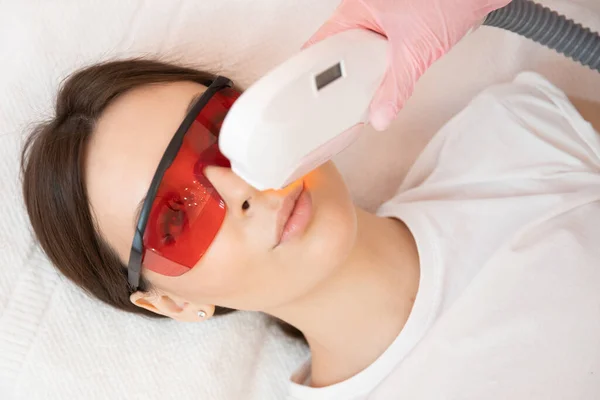 Laserowe usuwanie włosów niechciane na twarzy młodej kobiety. Koncepcja zdrowia i piękna — Zdjęcie stockowe