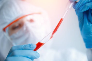 İnsanlara karşı gizli biyolojik silahlar geliştirmek, virüs salgını ve hayvan enfeksiyonu. Bilinmeyen hastalık salgını kavramı