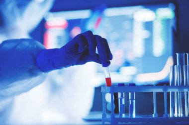 2019-ncov Coronavirus yaşam için tehlikeli laboratuvar kan testi tespiti. Salgın Aşı Konsepti