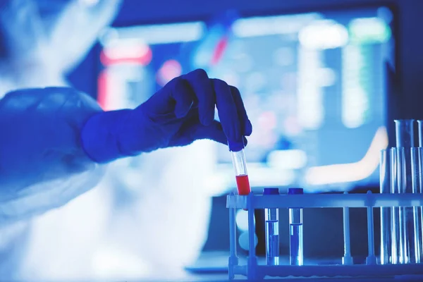 Detecção de exames laboratoriais de sangue 2019-ncov coronavírus de perigoso para a vida. Conceito de vacina pandémica — Fotografia de Stock