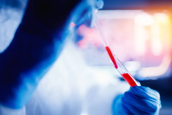 Verpleegster biologisch gevaar met positief bloedonderzoek Coronavirus in gezondheidslaboratorium — Stockfoto