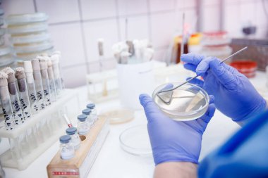 Mikrobiyoloji el hekimi, laboratuvar ve bakteri tanımlamasında tarım tabakası bakterileri ve patojenlerin ilaç direnci üzerinde çalışıyor.