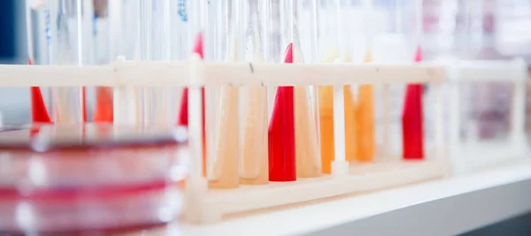 Laboratório de microbiologia cultivo de leveduras em placa de ágar médio, fundo branco — Fotografia de Stock