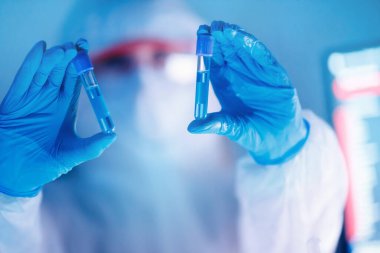 Çin 'de ve dünyada virüsten etkilenen insanların sayısı analiz ediliyor. Laboratuvarda solunum cihazına bağlı koruyucu kimyasal giysili bir doktor.
