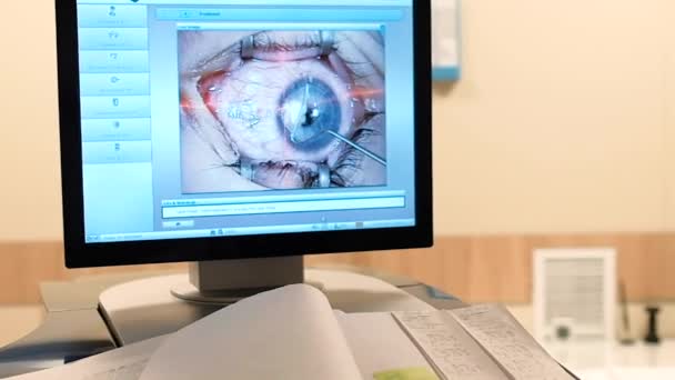 Corrección Visión Láser Paciente Cirujano Quirófano Durante Cirugía Oftálmica Ojo — Vídeos de Stock