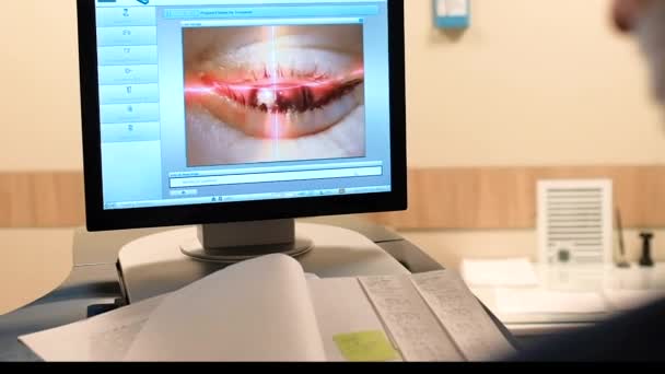 Corrección Visión Láser Paciente Cirujano Quirófano Durante Cirugía Oftálmica Ojo — Vídeos de Stock
