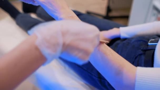 Beautician arts zet gel op de hand van meisje voor laser ontharing — Stockvideo