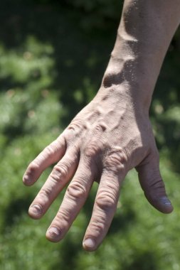 Erkekler üzerinde hasta çivi; s el