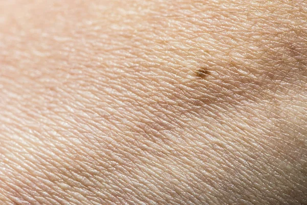 Human skin close up