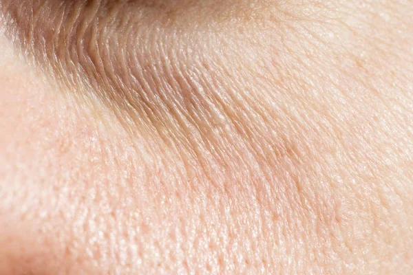 Wrinkles under the eyes — Stock Photo, Image