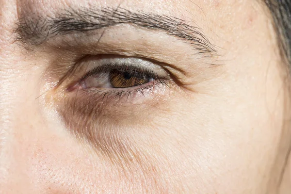 Wrinkles under the eye — Stock Photo, Image