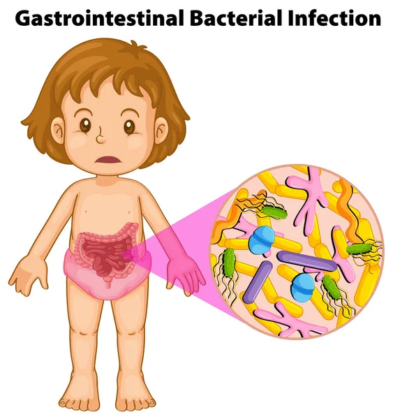 Emberi lány és a gyomor bakteriális fertőzés — Stock Vector