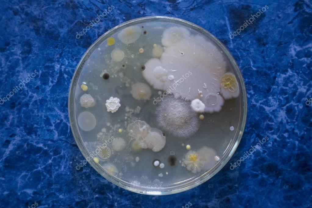 Colonies Bacteria Petri Dish Mold Bacilli — Stock Photo © NikolayAsasis