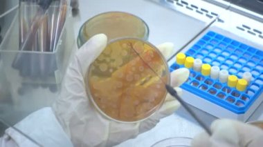 Mikrobiyolojik laboratuvar çalışma. Laboratuvarda deneme. Örnek seçimi. Bakterilerin bir petri üzerinde büyük bir yük bitki. Labortory, gerçek eser.