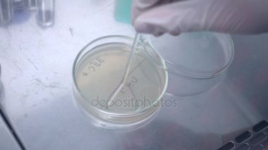 Laboratuvarda deneme. Örnek seçimi. Mikrobiyolojik laboratuvar çalışma. Bakterilerin bir petri üzerinde büyük bir yük bitki.