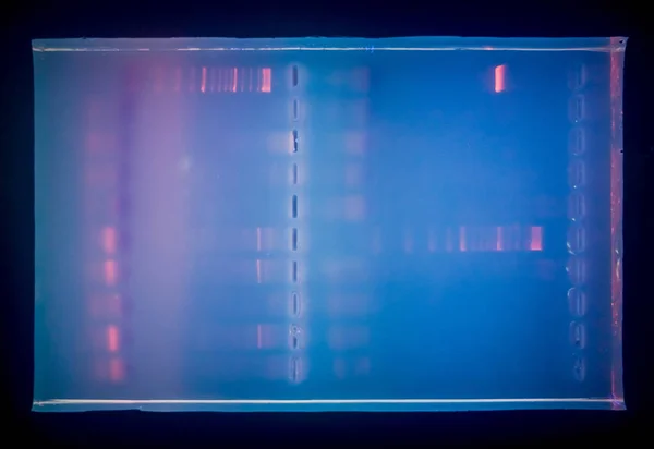 Close Gel Com Dna Após Eletroforese Resultados Eletroforese Após Pcr Fotografia De Stock