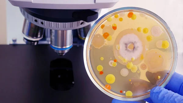 Bacterial analysis in the laboratory. A Petri dish with colored bacteria on the background of the microscope.