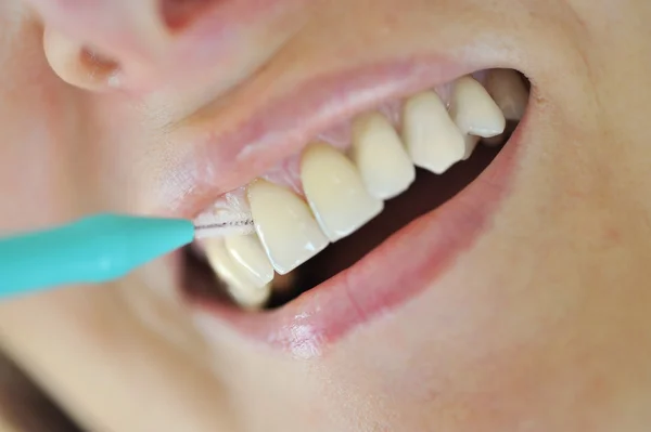 Una mujer limpiando sus dientes — Foto de Stock