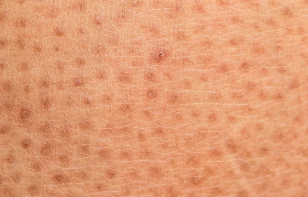 gros plan de lhomme de peau macro epidermis photo thinkstock photos de ichtyose images de ichtyose depositphotos 174 gros plan de lhomme de peau macro epidermis photo thinkstock photos de ichtyose images de ichtyose depositphotos 174