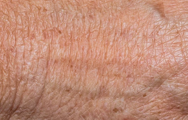 Primer plano de la piel de la mano para el fondo y la textura — Foto de Stock
