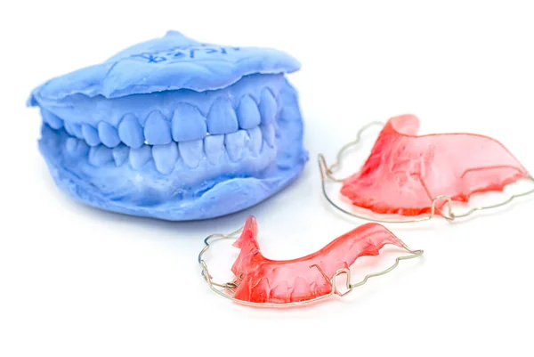 Retenedor de ortodoncia superior e inferior, aparatos dentales — Foto de Stock