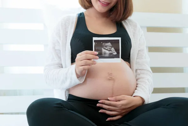 Happy pregnant woman is showing the ultrasound image. — Stock Photo, Image