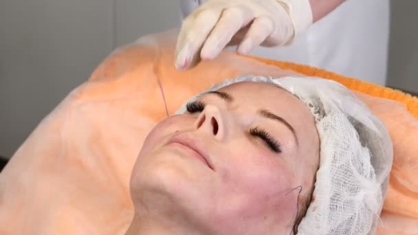 Klinika urody. Młoda kobieta klienta pobiera wątku lifting twarzy. Kosmetyczki w rękawice, co twarz Anti-Aging na twarz kobiety — Wideo stockowe