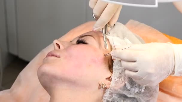 Clínica de saúde. Jovem cliente feminina recebe procedimento de elevação de rosto de fio. Esteticista em luvas fazendo rosto anti-envelhecimento para um rosto feminino — Vídeo de Stock