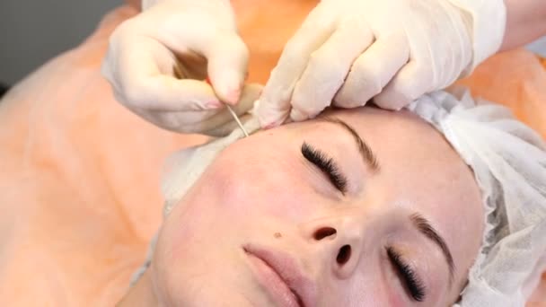 Clínica de saúde. Jovem cliente feminina recebe procedimento de elevação de rosto de fio. Esteticista em luvas fazendo rosto anti-envelhecimento para um rosto feminino — Vídeo de Stock