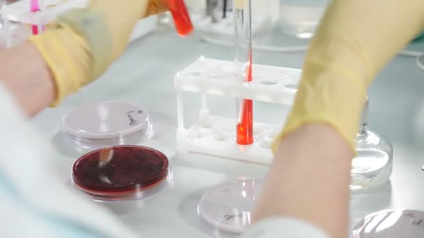 Μικροβιακές αποικίες σε τρυβλίο Petri. Αποικία μικροβίων και παθογόνων μυκήτων. Μικροβιολογικές εργαστηριακές εργασίες. Εργαστήριο ανθρώπινης ανάλυσης. Κοντινό πλάνο ενός επιστήμονα που δουλεύει στο εργαστήριο. 4 k βίντεο — Αρχείο Βίντεο