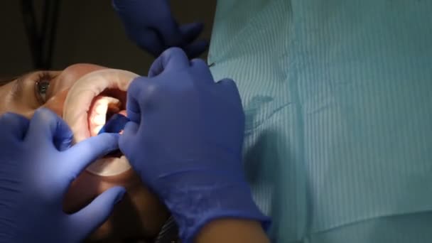 Espesialista dental preparando los dientes del paciente para las carillas de cerámica con herramientas especiales. Imagen oscura. Odontología cosmética, medicina, concepto estomatológico. Tecnología médica moderna procedimiento de chapa dental. 4 k — Vídeos de Stock