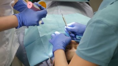 Dental spesialist preparing patient teeth for ceramic veneers with special tools. Cosmetic dentistry, medicine, stomatology concept. Modern medical technology dental veneer procedure. 4 k video