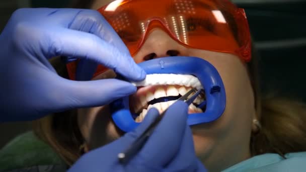 Concepto de clínica dental moderna. Vista superior. Preparación para el blanqueamiento dental cosmético profesional en la clínica odontológica. Paciente femenina en consulta odontológica en silla. Procedimiento de blanqueamiento de dientes.. Primer plano. 4 k — Vídeo de stock