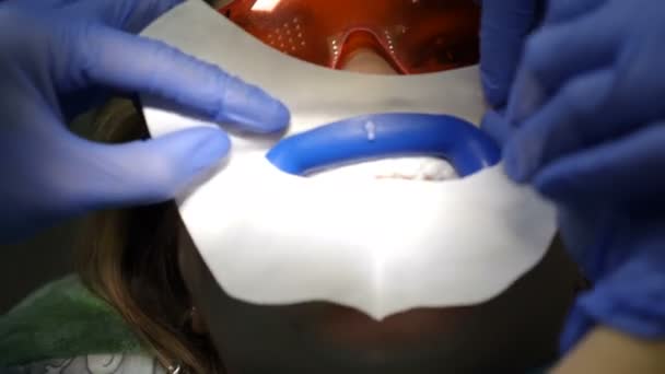 Moderne tandheelkundige kliniek concept. Bovenaanzicht. Voorbereiding voor professionele cosmetische tanden bleken in tandarts kliniek. Vrouwelijke patiënt in tandartspraktijk op stoel. Teeth whitening procedure... close-up. 4 km — Stockvideo
