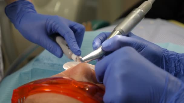 Trattamento dentale vista dall'alto. Dentista al lavoro, primo piano. Il paziente viene sottoposto a intervento chirurgico medico e trattamento della cavità orale presso l'odontoiatria moderna. 4K video — Video Stock