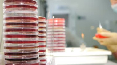 Petri kabında mikrop ve patojenik mantar kolonisi. Mikrobiyolojik laboratuvar işi. İnsan analiz laboratuvarı. Reseach Laboratuvarı 'nda çalışan bilim adamının yakın çekimi. 4k video