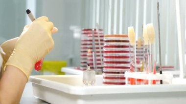 Mikrobiyoloji Laboratuvarı: Bilim adamı Petri Çanaklarıyla Çeşitli Bakterilerle Çalışıyor, elinde yazı kalemi var. Doku ve kan örnekleri. Antibiyotikler için ilaç araştırması, DNA ile hastalıkların tedavisi