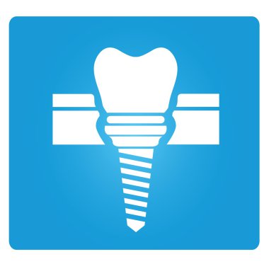 diş implantı mavi arka planda