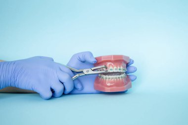 Metal diş telleri ve destek sistemlerinin düzeltilmesi için aletler. Ortodontist için diş aletleri. Bir ortodontiste gülümsemenin düzeltilmesi. Bir diş kliniğinde mavi arka planda diş aletleri. Doktor elinde diş teli olan bir çene tutar.