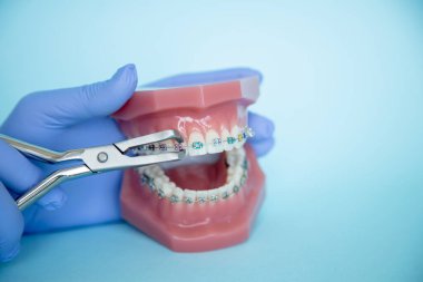 Metal diş telleri ve destek sistemlerinin düzeltilmesi için aletler. Diş telleri için renkli lastik bantlar. Bir ortodontiste gülümsemenin düzeltilmesi. Bir diş kliniğinde mavi arka planda diş aletleri. Doktor elinde diş teli olan bir çene tutar.