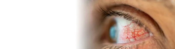 Augenprofilansicht mit einem Durcheinander von Venen und Textflächen — Stockfoto