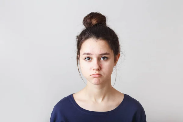 Portrait of a pimply teenage girl in a blue T-shirt on a gray background, sad face — Stock Photo, Image